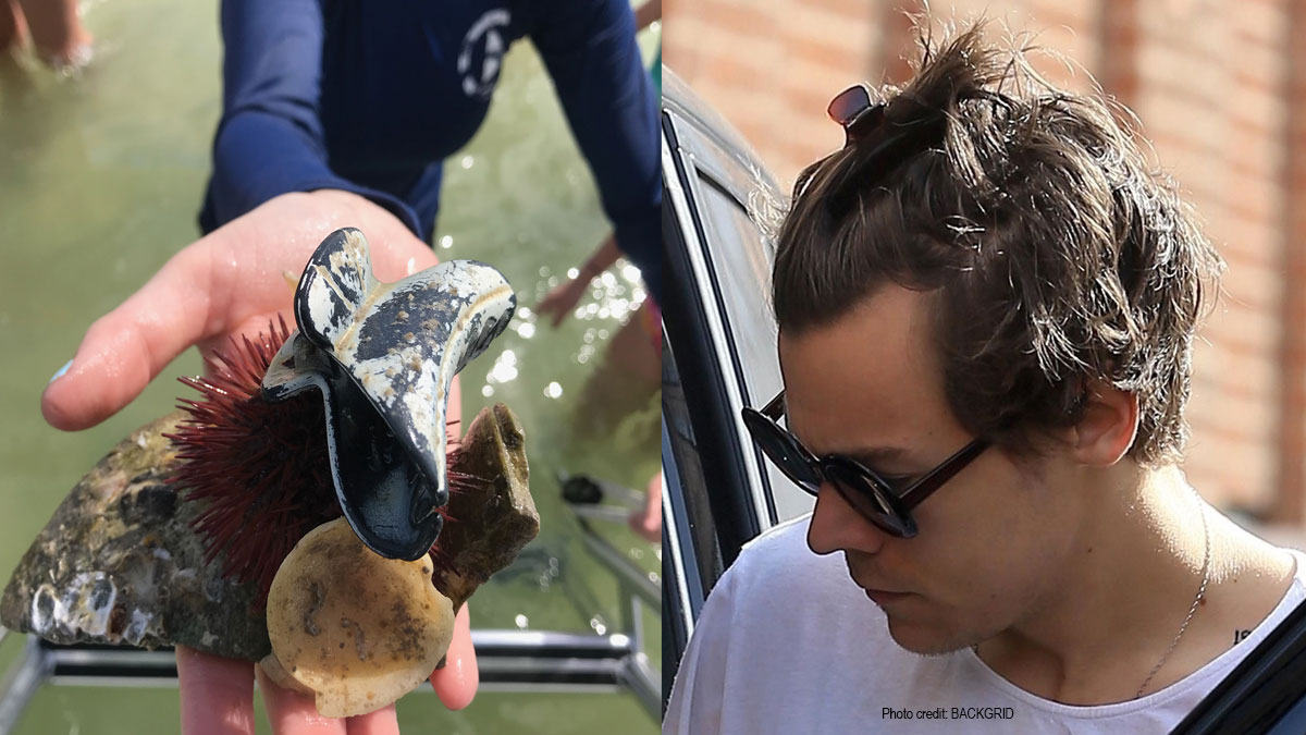 Harry the sea urchin named after Harry Styles hair clip fashion.